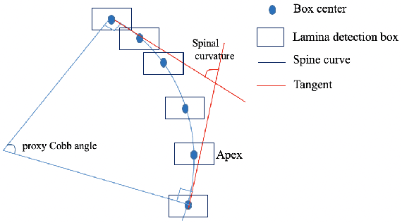 Figure 2 for Automatic spinal curvature measurement on ultrasound spine images using Faster R-CNN