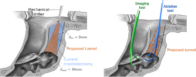 Figure 2 for Contributions à l'asservissement visuel et à l'imagerie en médecine