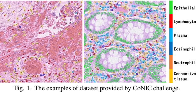 Figure 1 for Using Multi-scale SwinTransformer-HTC with Data augmentation in CoNIC Challenge