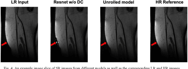 Figure 3 for Magnitude-image based data-consistent deep learning method for MRI super resolution
