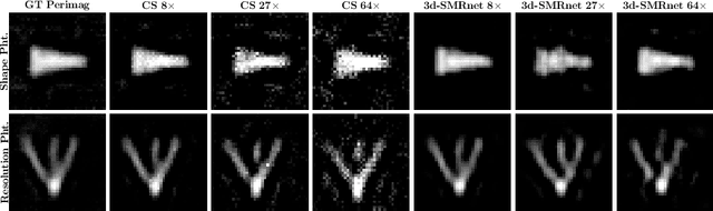 Figure 4 for 3d-SMRnet: Achieving a new quality of MPI system matrix recovery by deep learning