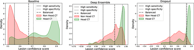 Figure 1 for Transformer-based out-of-distribution detection for clinically safe segmentation