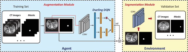 Figure 1 for Automatic Data Augmentation via Deep Reinforcement Learning for Effective Kidney Tumor Segmentation