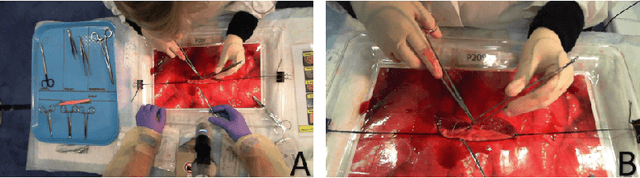 Figure 1 for Open surgery tool classification and hand utilization using a multi-camera system