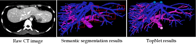 Figure 1 for TopNet: Topology Preserving Metric Learning for Vessel Tree Reconstruction and Labelling