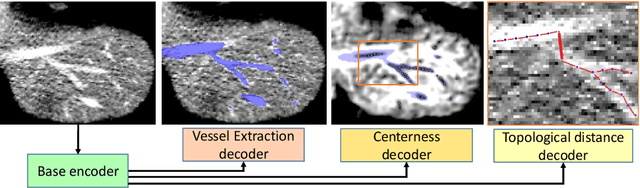 Figure 3 for TopNet: Topology Preserving Metric Learning for Vessel Tree Reconstruction and Labelling
