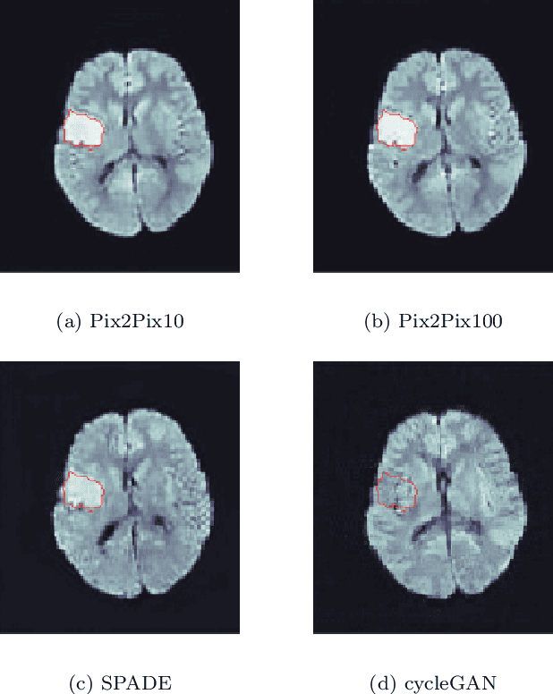 Figure 4 for Image Translation for Medical Image Generation -- Ischemic Stroke Lesions