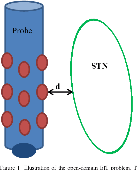 Figure 1 for A Post-Processing Tool and Feasibility Study for Three-Dimensional Imaging with Electrical Impedance Tomography During Deep Brain Stimulation Surgery