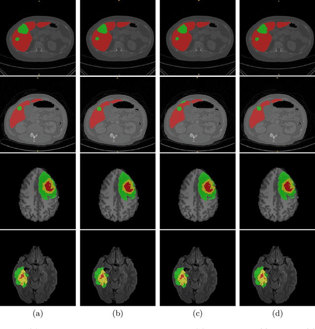 Figure 4 for UNetFormer: A Unified Vision Transformer Model and Pre-Training Framework for 3D Medical Image Segmentation