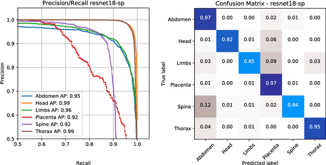 Figure 4 for Weakly Supervised Localisation for Fetal Ultrasound Images