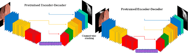 Figure 3 for Double Encoder-Decoder Networks for Gastrointestinal Polyp Segmentation
