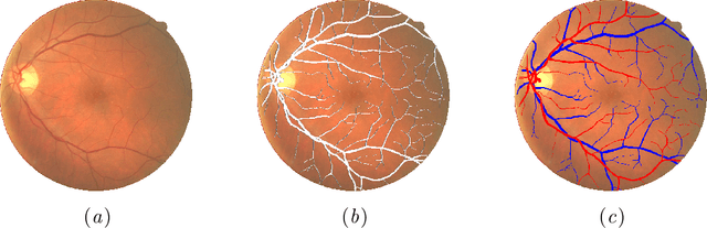 Figure 1 for Joint Learning of Vessel Segmentation and Artery/Vein Classification with Post-processing