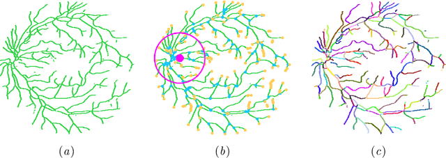 Figure 4 for Joint Learning of Vessel Segmentation and Artery/Vein Classification with Post-processing