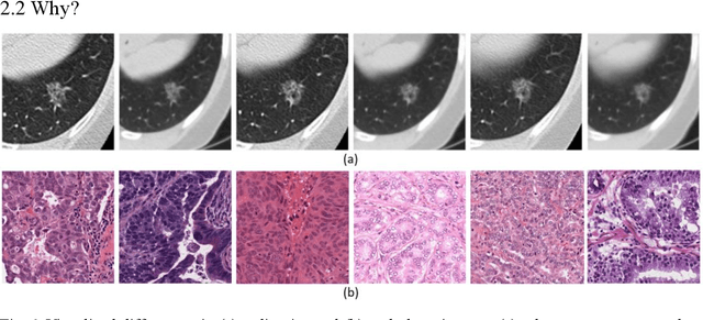 Figure 2 for Data Harmonisation for Information Fusion in Digital Healthcare: A State-of-the-Art Systematic Review, Meta-Analysis and Future Research Directions