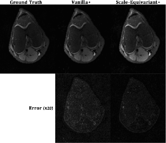 Figure 2 for Scale-Equivariant Unrolled Neural Networks for Data-Efficient Accelerated MRI Reconstruction