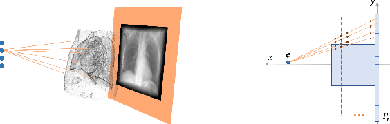 Figure 1 for Fluid registration between lung CT and stationary chest tomosynthesis images