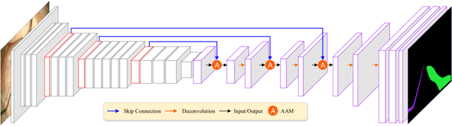 Figure 1 for RAUNet: Residual Attention U-Net for Semantic Segmentation of Cataract Surgical Instruments