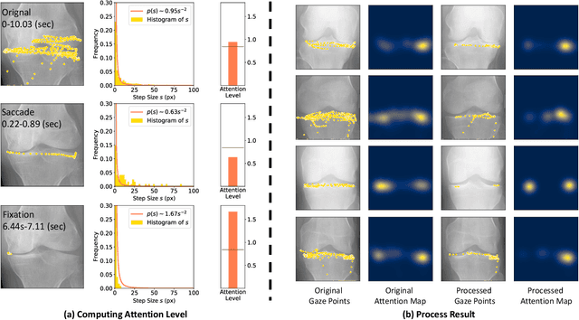 Figure 4 for Follow My Eye: Using Gaze to Supervise Computer-Aided Diagnosis