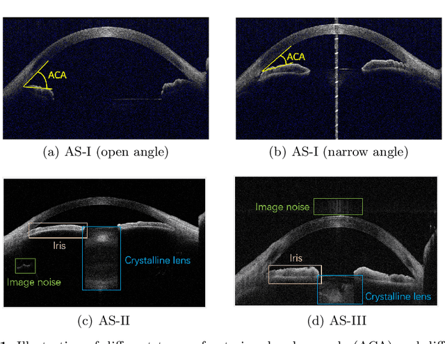 Figure 1 for Multi-Scale Multi-Target Domain Adaptation for Angle Closure Classification