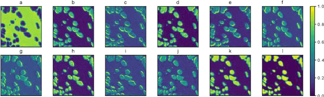 Figure 3 for A Light-weight Interpretable CompositionalNetwork for Nuclei Detection and Weakly-supervised Segmentation