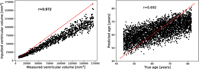 Figure 4 for Brain Imaging Generation with Latent Diffusion Models