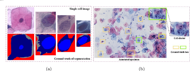 Figure 3 for A Novel Automation-Assisted Cervical Cancer Reading Method Based on Convolutional Neural Network