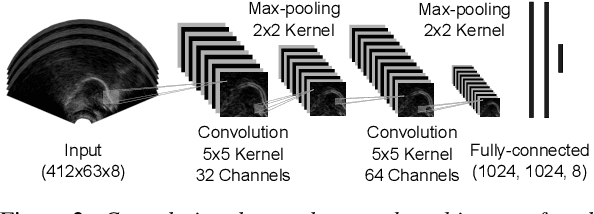 Figure 3 for Ultrasound tongue imaging for diarization and alignment of child speech therapy sessions