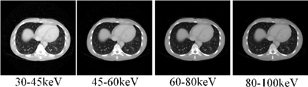 Figure 1 for S2MS: Self-Supervised Learning Driven Multi-Spectral CT Image Enhancement