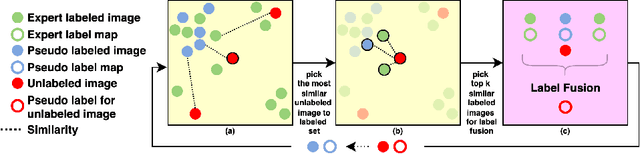 Figure 2 for CORPS: Cost-free Rigorous Pseudo-labeling based on Similarity-ranking for Brain MRI Segmentation