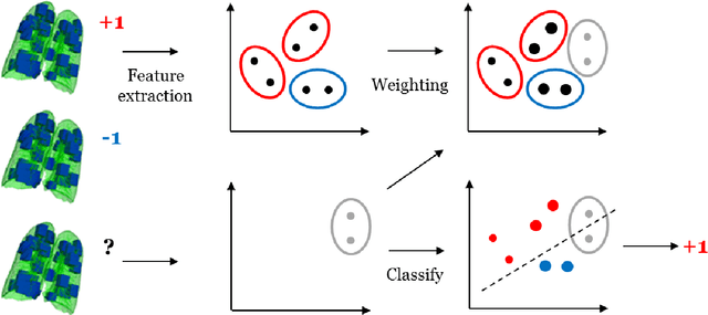 Figure 1 for Transfer learning for multi-center classification of chronic obstructive pulmonary disease