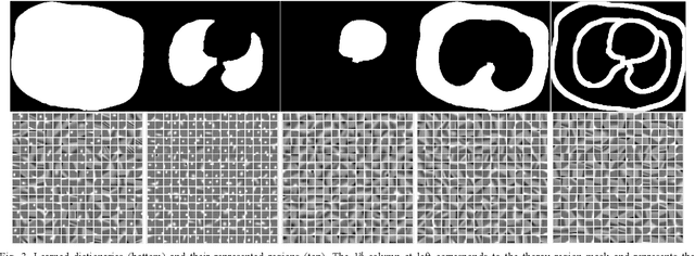 Figure 3 for Region-specific Dictionary Learning-based Low-dose Thoracic CT Reconstruction