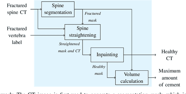 Figure 2 for Patient-specific virtual spine straightening and vertebra inpainting: An automatic framework for osteoplasty planning