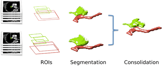 Figure 1 for Computer Aided Detection for Pulmonary Embolism Challenge (CAD-PE)