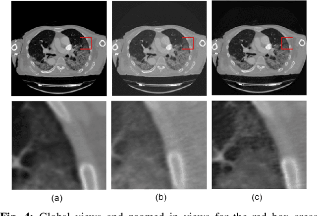 Figure 4 for A Deep-Learning Framework for Improving COVID-19 CT Image Quality and Diagnostic Accuracy