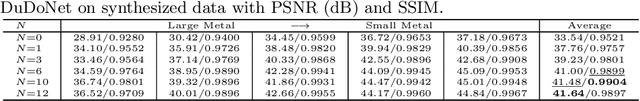 Figure 2 for InDuDoNet: An Interpretable Dual Domain Network for CT Metal Artifact Reduction