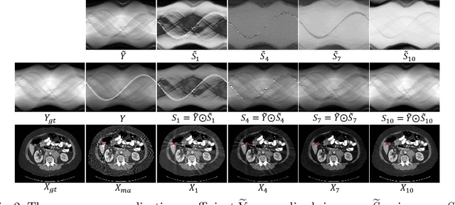Figure 3 for InDuDoNet: An Interpretable Dual Domain Network for CT Metal Artifact Reduction