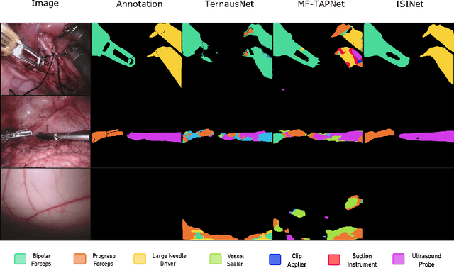 Figure 4 for ISINet: An Instance-Based Approach for Surgical Instrument Segmentation