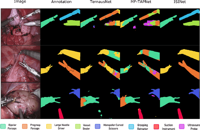 Figure 1 for ISINet: An Instance-Based Approach for Surgical Instrument Segmentation