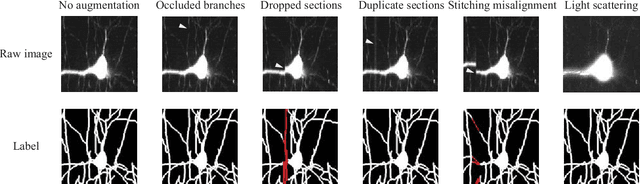Figure 1 for Reconstructing neuronal anatomy from whole-brain images