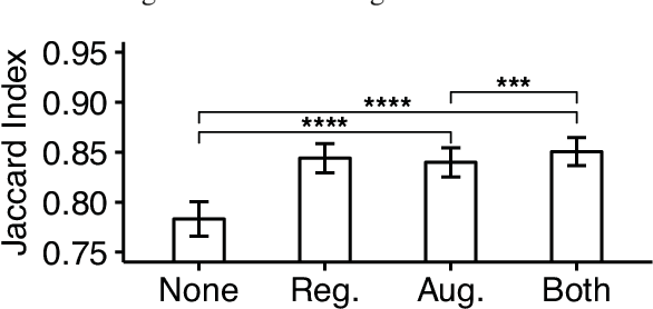 Figure 3 for Reconstructing neuronal anatomy from whole-brain images