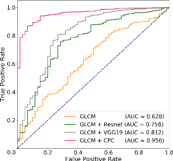 Figure 3 for Weakly Supervised Prostate TMA Classification via Graph Convolutional Networks