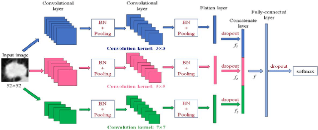 Figure 1 for Multi-level CNN for lung nodule classification with Gaussian Process assisted hyperparameter optimization