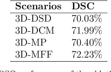 Figure 2 for A lateral semicircular canal segmentation based geometric calibration for human temporal bone CT Image