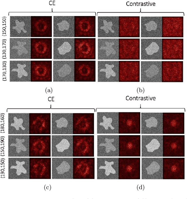 Figure 4 for The Effect of the Loss on Generalization: Empirical Study on Synthetic Lung Nodule Data