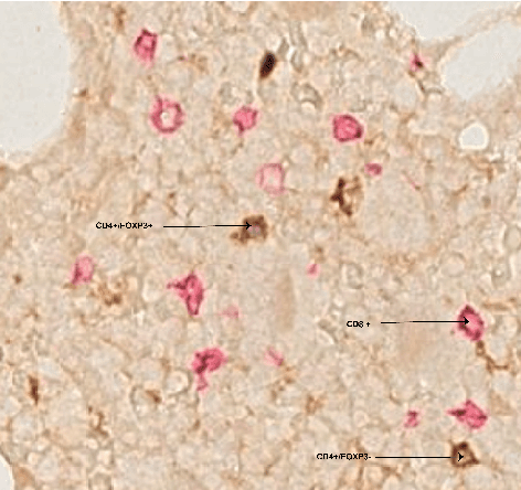 Figure 1 for Cell abundance aware deep learning for cell detection on highly imbalanced pathological data
