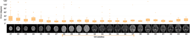 Figure 2 for Real-time Deep Pose Estimation with Geodesic Loss for Image-to-Template Rigid Registration
