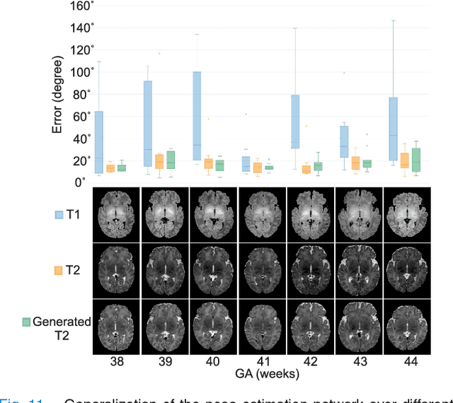 Figure 3 for Real-time Deep Pose Estimation with Geodesic Loss for Image-to-Template Rigid Registration