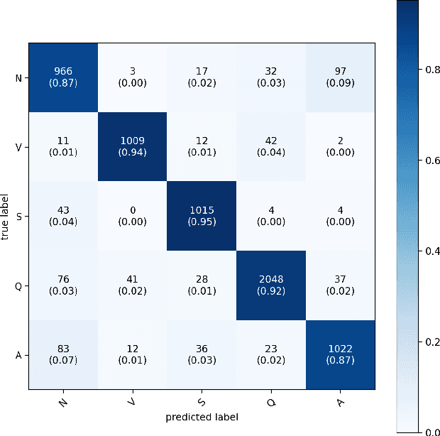Figure 2 for A Wearable ECG Monitor for Deep Learning Based Real-Time Cardiovascular Disease Detection