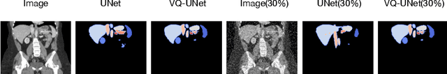 Figure 4 for Vector Quantisation for Robust Segmentation