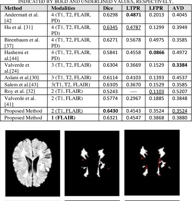 Figure 4 for Multiple Sclerosis Lesions Segmentation using Attention-Based CNNs in FLAIR Images